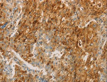 CEACAM8/CD66b Antibody
