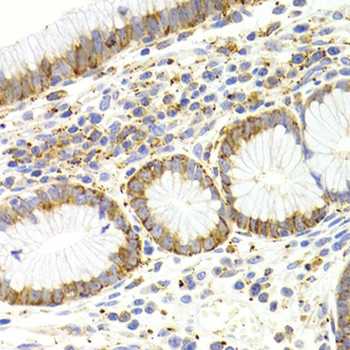 KISS1R/GPR54 Antibody