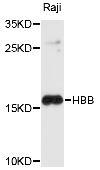 HBB/Hemoglobin Beta Antibody