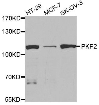 PKP2/Plakophilin 2 Antibody