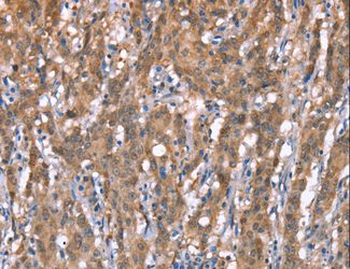 GPC6/Glypican 6 Antibody