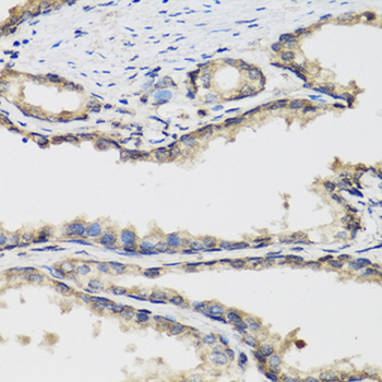 LP-PLA2/PLA2G7 Antibody