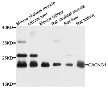 CACNG1/CACNG Antibody