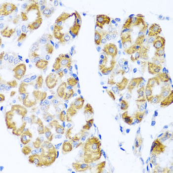 CCL17/TARC Antibody