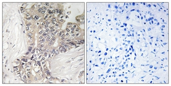 B3GALTL Antibody