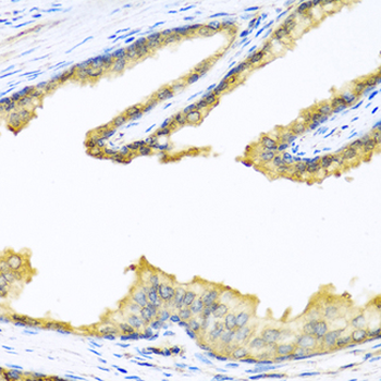 Proenkephalin/PENK Antibody