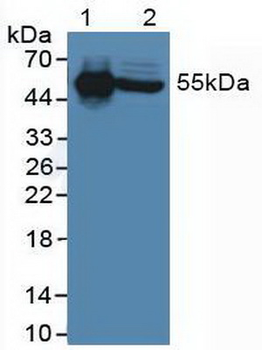 IL6R/IL6 Receptor Antibody