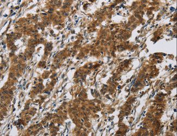 IL17RB Antibody
