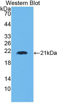 HMMR/CD168/RHAMM Antibody