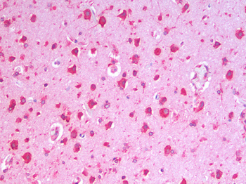 HSPA5/GRP78/BiP Antibody