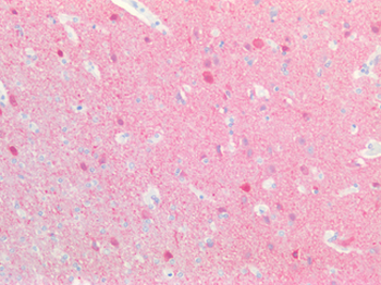 UCHL1/PGP9.5 Antibody