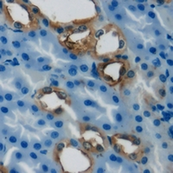 PCCB Antibody
