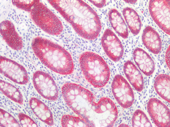 CDH1/E Cadherin Antibody