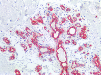 KRT8/CK8/Cytokeratin 8 Antibody