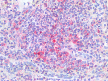 PDCD1/CD279/PD-1 Antibody