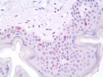CD207/Langerin Antibody