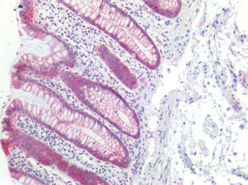CDH1/E Cadherin Antibody