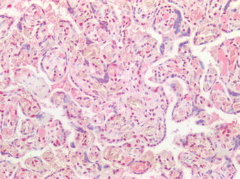 TDP-43/TARDBP Antibody