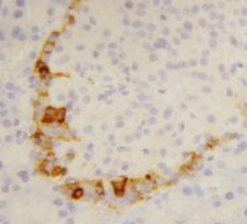 SST/Somatostatin Antibody