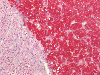 SLC27A1/FATP Antibody