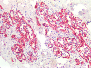 SMMHC/MYH11 Antibody
