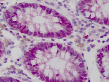 WDHD1 Antibody