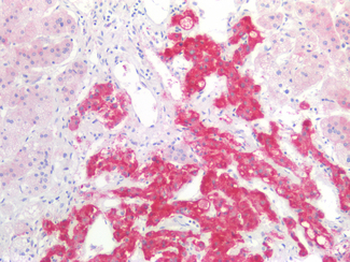 HSD17B12 Antibody