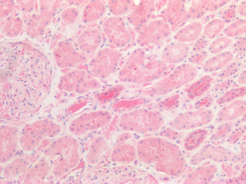 HABP2 Antibody