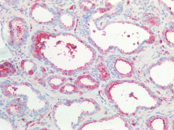 CTNNBIP1/ICAT Antibody