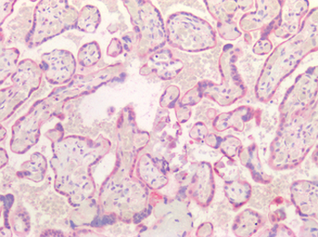 TGFB2/TGF Beta2 Antibody