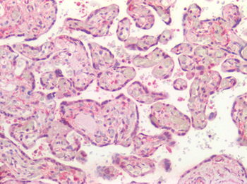 BMP4 Antibody