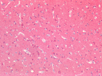 HPRT1/HPRT Antibody