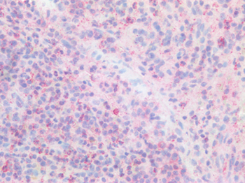 DGKA Antibody