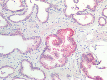 CTNNBIP1/ICAT Antibody