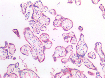 HEXB Antibody