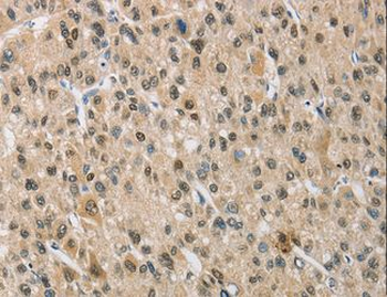 NAPSA/NAPA/Napsin A Antibody