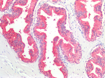 ACPP/PAP Antibody