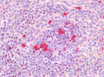 TS/Thymidylate Synthase Antibody