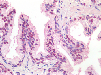TICAM1/TRIF Antibody