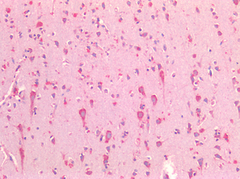 HSPA5/GRP78/BiP Antibody