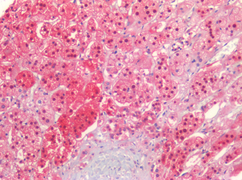QPRT Antibody