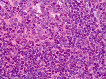 TK1/TK/Thymidine Kinase Antibody