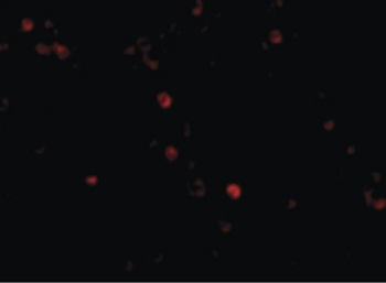 IFIH1/MDA5 Antibody