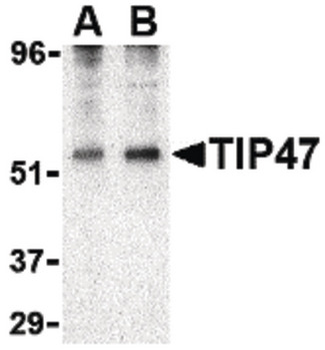 PLIN3/M6PRBP1/TIP47 Antibody