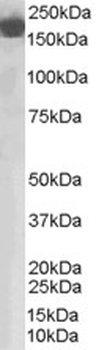 CFH/Complement Factor H Antibody