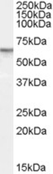 PDE11A Antibody