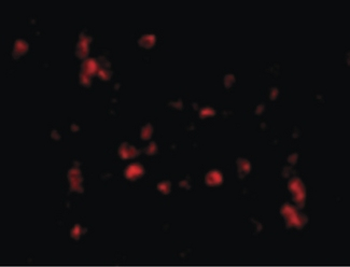 LL37/Cathelicidin Antibody