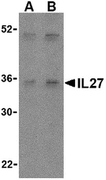 IL27 Antibody