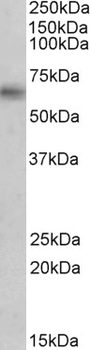 MAOB/Monoamine Oxidase B Antibody