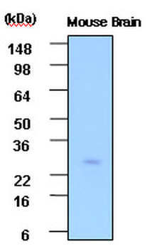 PSPH Antibody